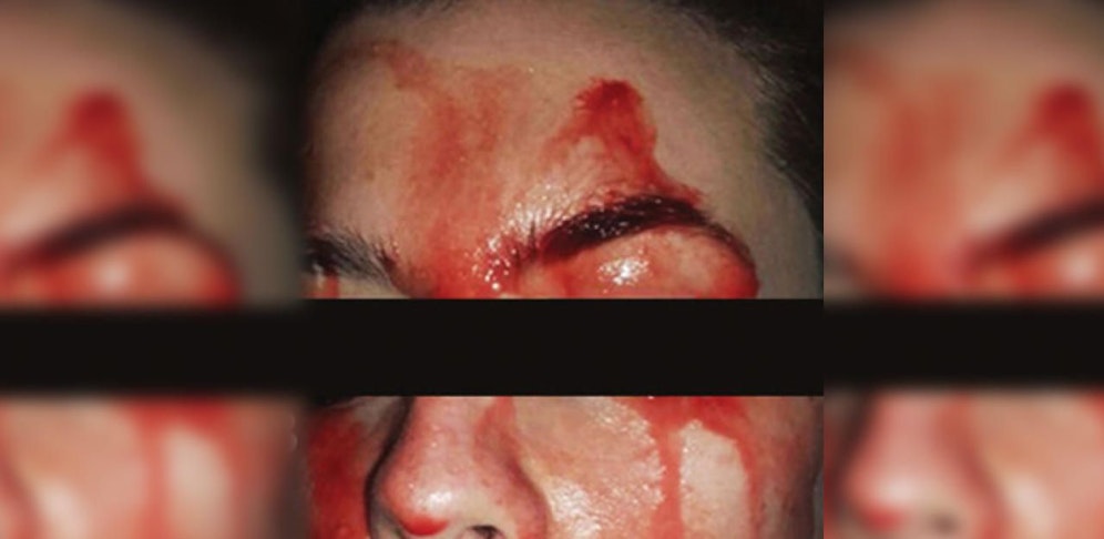 Das Gesicht der Frau ist blutverschmiert