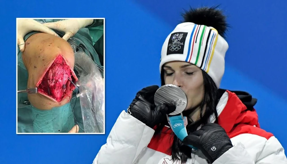 Anna Veith zeigt ihr Knie