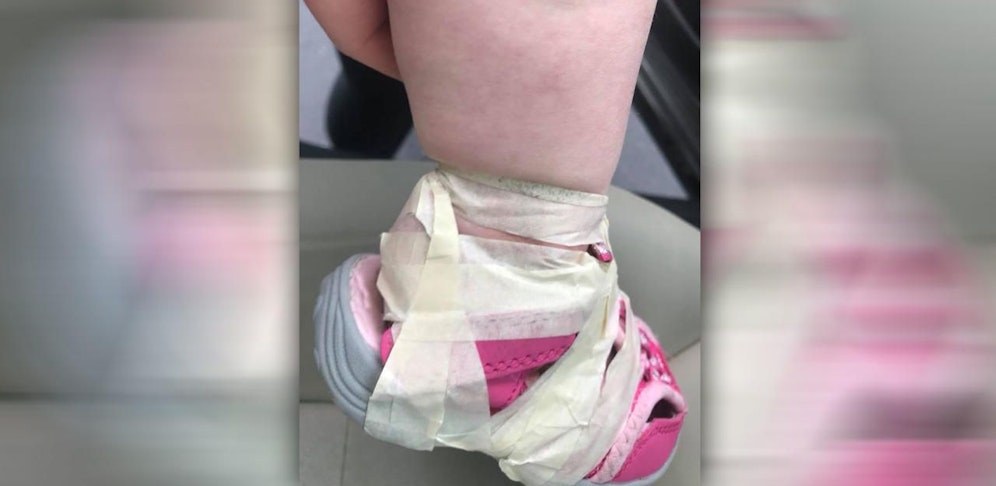 Das Klebeband war so fest dran, dass das Blut sich staute.