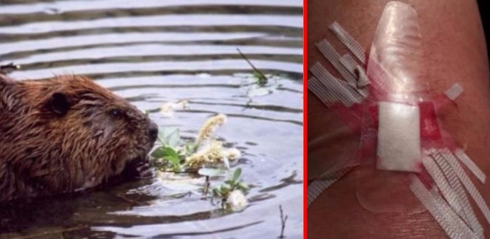 Biber beißt Schwimmerin