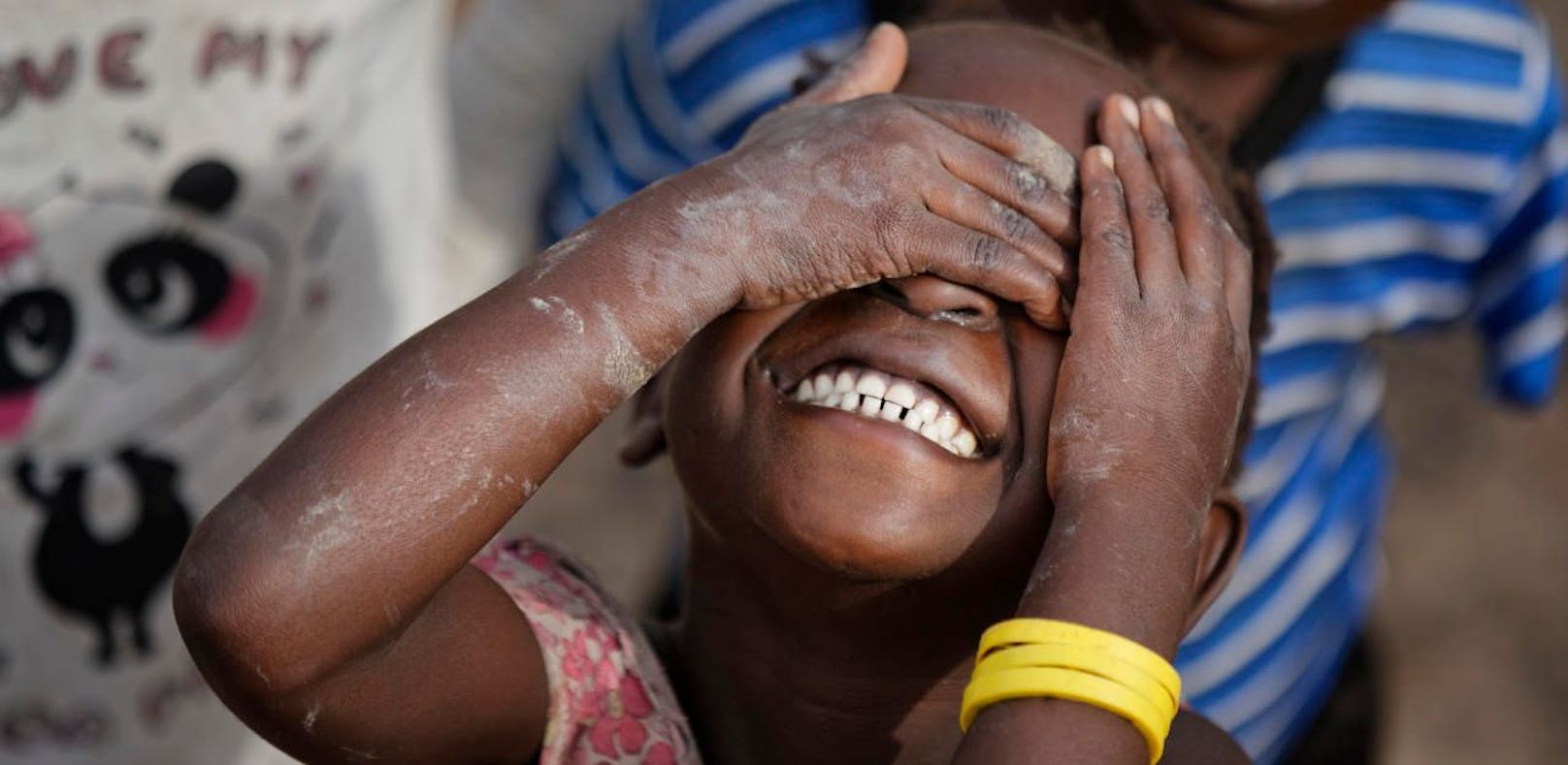 Sudan stellt Beschneidung von Mädchen unter Strafe