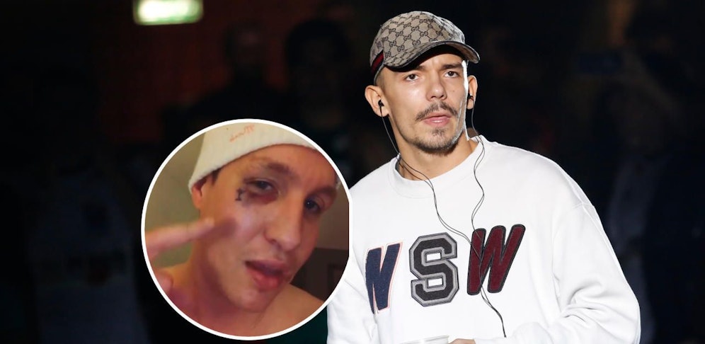 Der Fan zeigt sein Veilchen in einem Insta-Post.