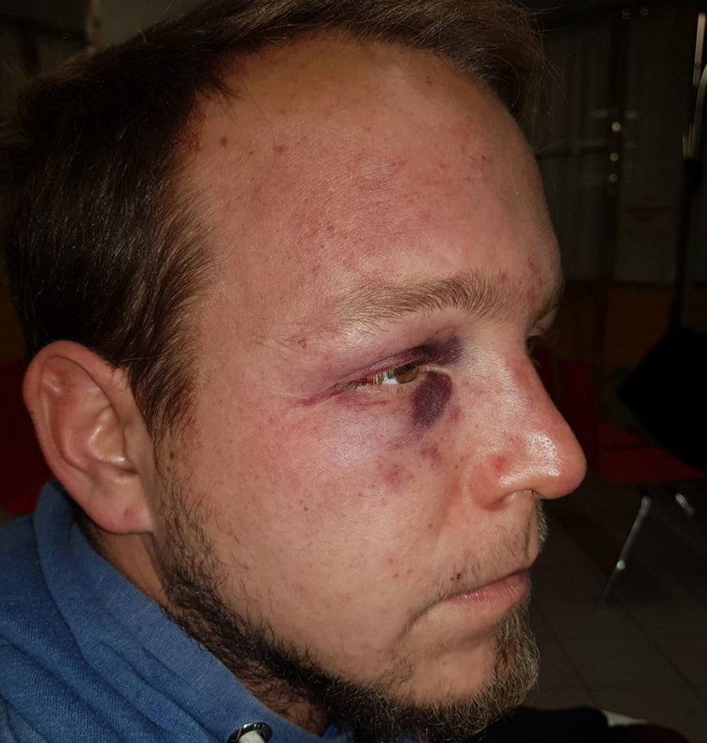 Michael I. nach der Prügelattacke.