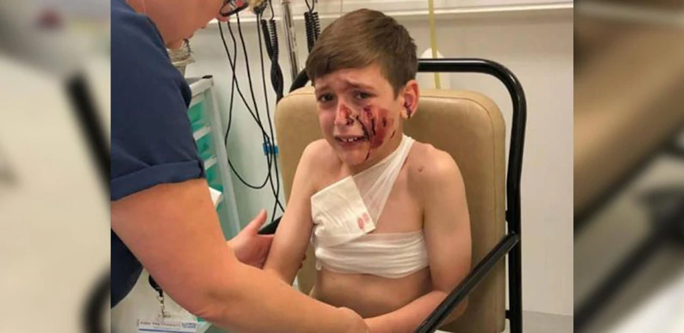 Der kleine Lewis (11) wurde schwer verletzt.