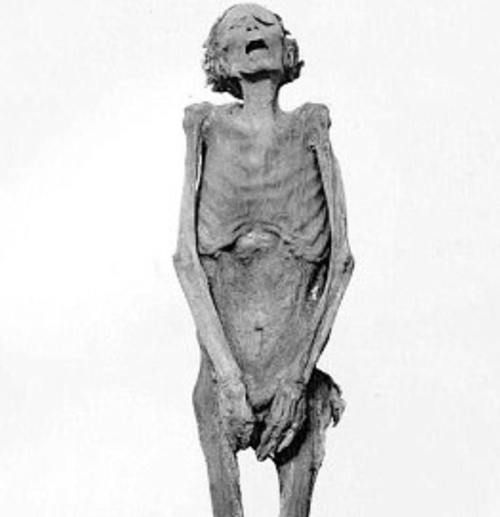 Grausig: Die "schreiende Mumie" sorgte seit 132 Jahren für Rätselraten. Jetzt kam heraus, dass es sich um den Sohn eines Pharaos handelt. 