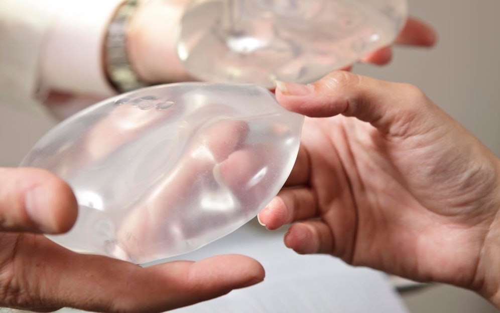 Eine Arbeitsgruppe soll untersuchen, wie stark der Zusammenhang zwischen Krebserkrankungen und Brustimplantaten tatsächlich ist.