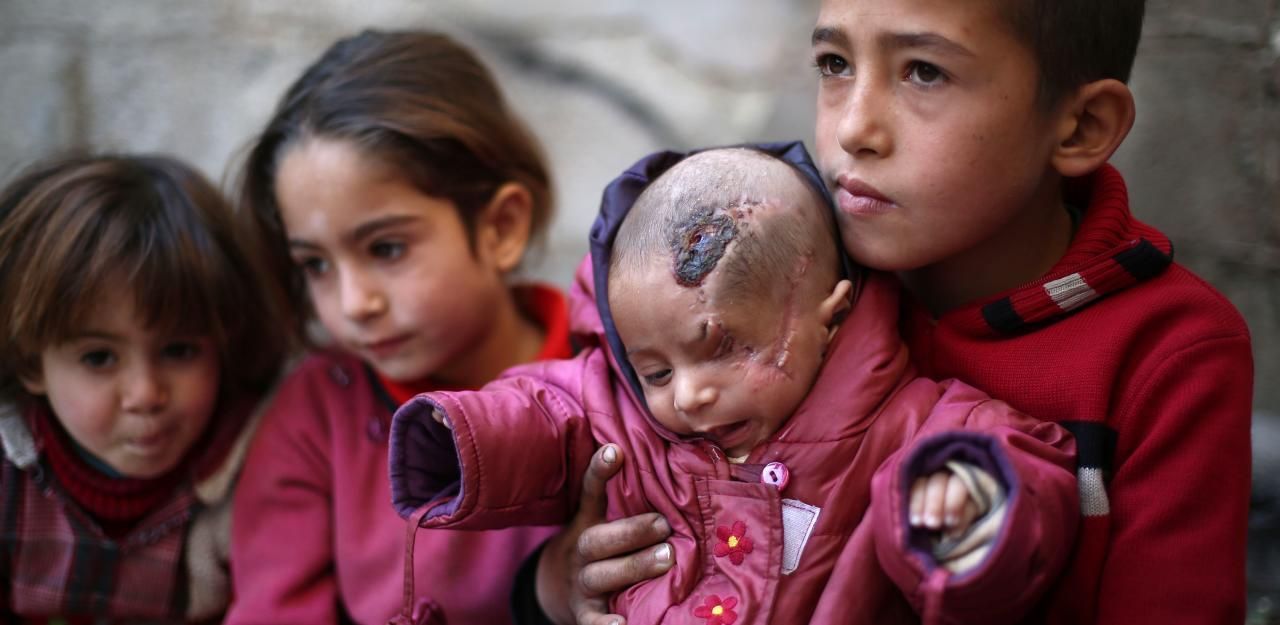 Heute.at - Baby Karim wird zum Symbol des Leids in Syrien