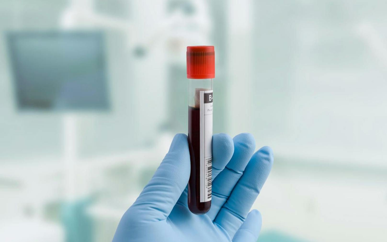 Mit nur einem Bluttest sollen 50 verschiedene Krebsarten erkannt und lokalisiert werden.