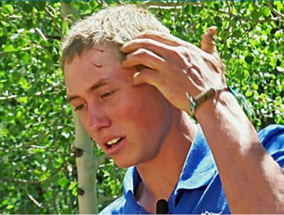 Dylan (19) wurde beim Angriff des Bären am Kopf verletzt. Credit: Screenshot Twitter