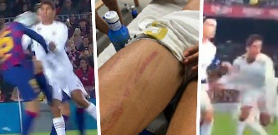 Die Elfmeter-Szenen unter der Lupe. Diese Fouls wurden nicht geahndet.