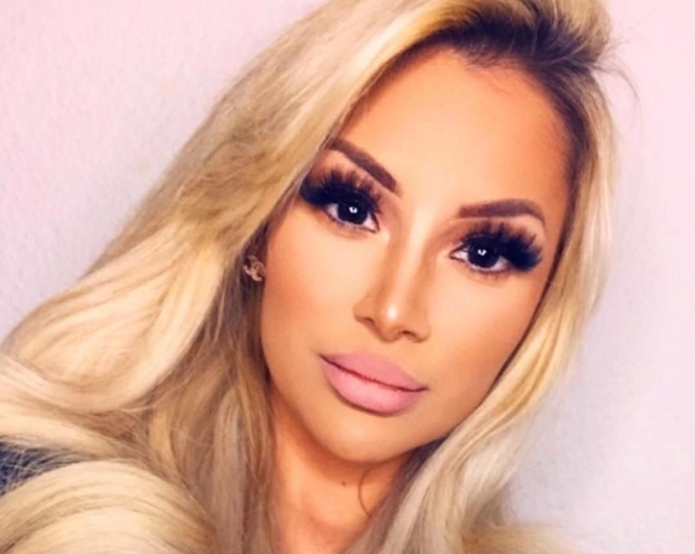 Die Wienerin steht zu ihren Beauty-Doc-Besuchen, ihrer neuen Nase, Lippe, Fake-Lashes und einem ordentlichen Fotofilter.