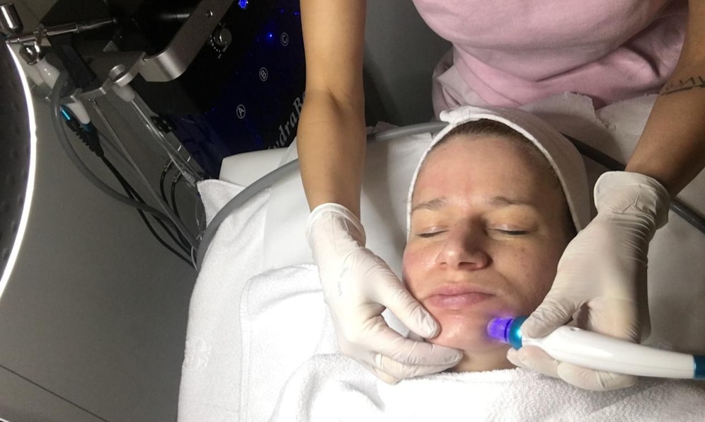 Bei einem Hydro-Facial werden die Unreinheiten und gelösten Talgablagerungen mittels Unterdruck aus den Poren gesaugt.