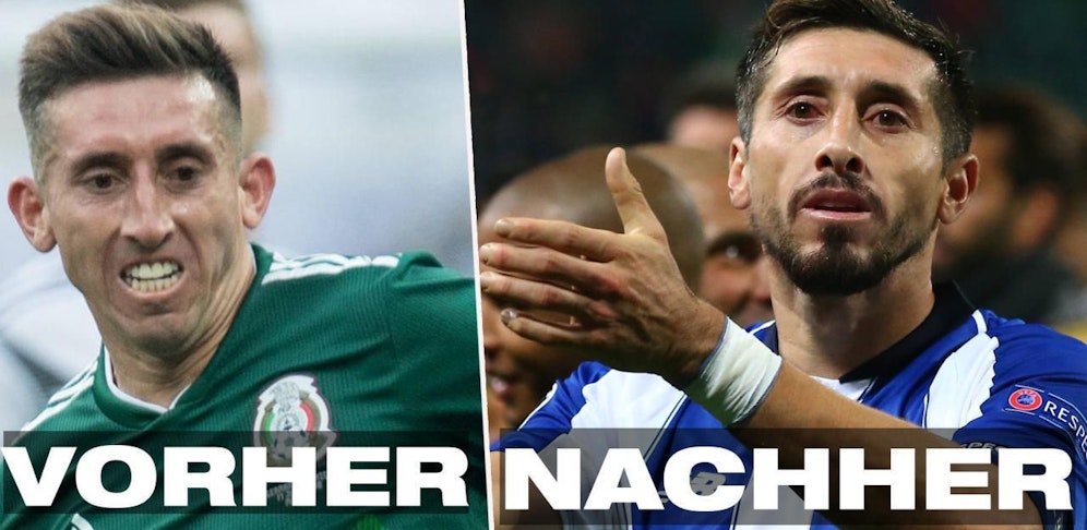 Hector Herrera legte sich nach der WM beim Schönheitschirurgen unters Messer.