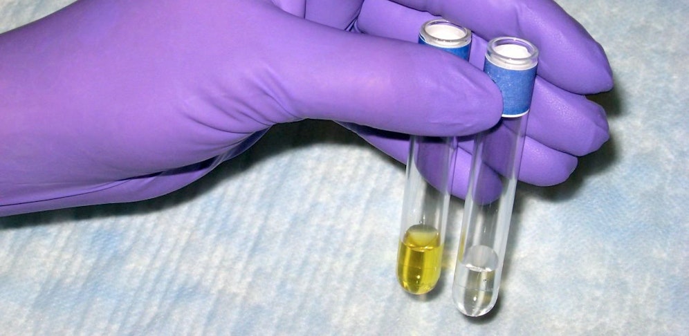 Symbolbild: So werden Drogen in Abwässern nachgewiesen.