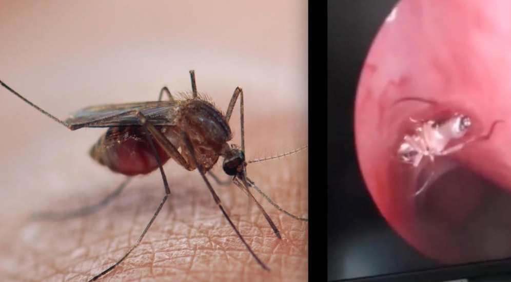 Summ, summ, summ! Der Moskito steckte in der Nase und lebte ...