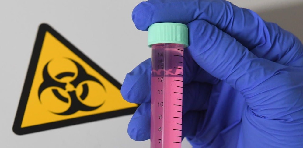 Forscher haben einen neuen resistenten Tuberkulosekeim entdeckt. Symbolfoto