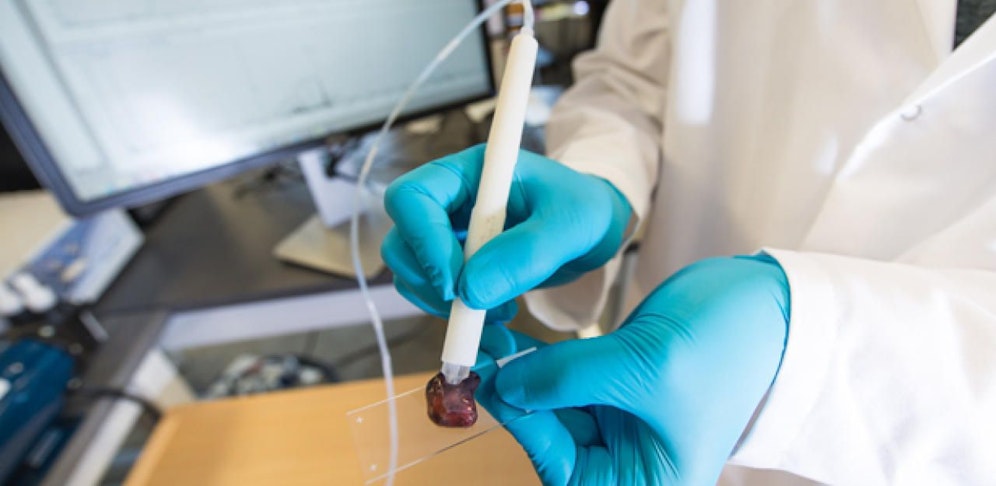 Mithilfe des neuen Verfahrens kann in Sekundenschnelle zwischen gesunden und Krebszellen unterschieden werden.