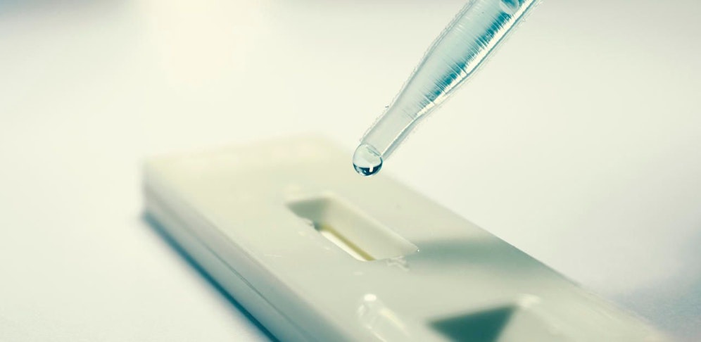 Teststreifen für einen Schnelltest.