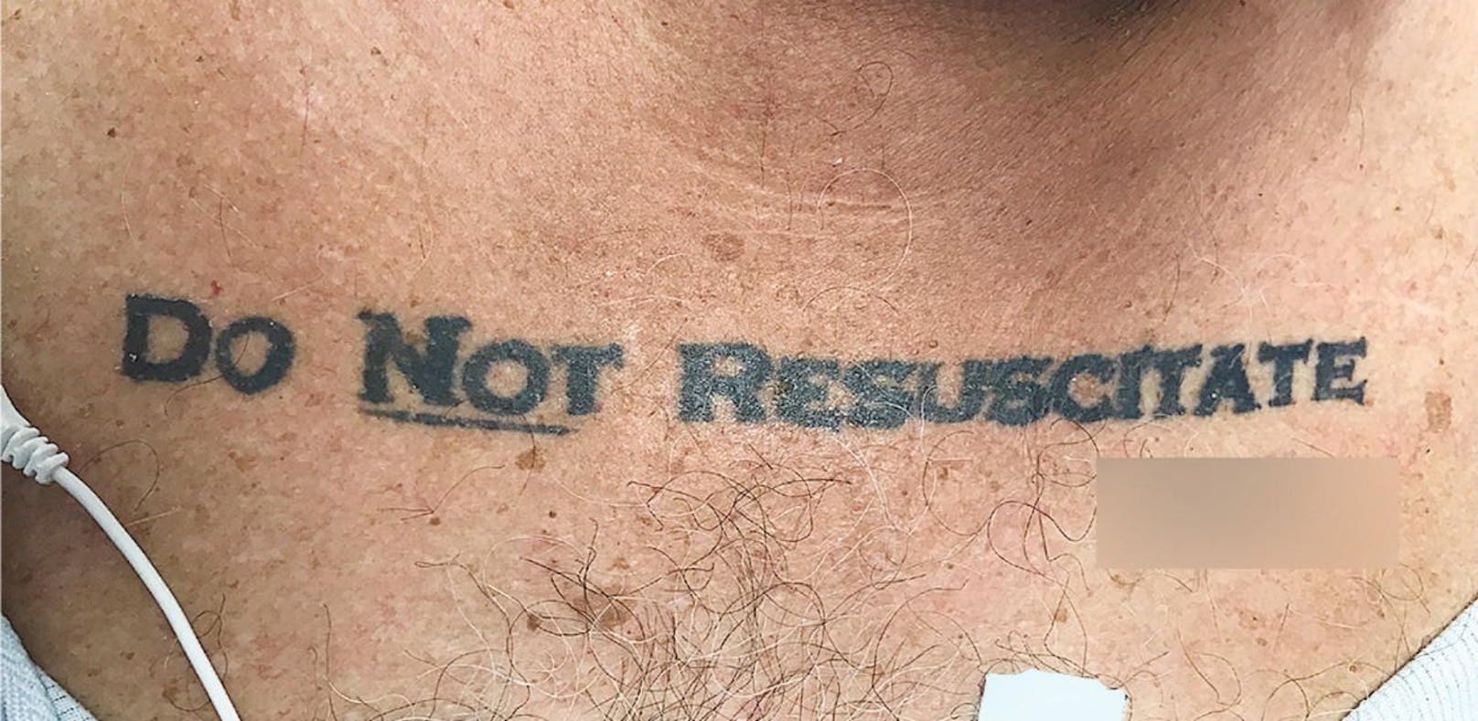 Was tun bei einem "Nicht wiederbeleben"-Tattoo?