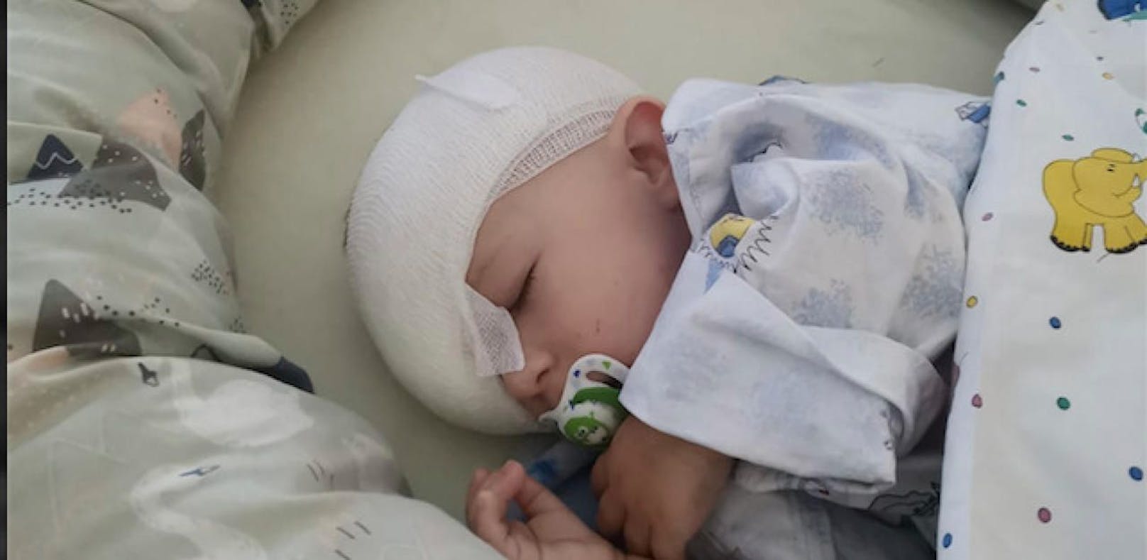 Der kleine Finn (10 Monate) nach seiner schweren Augen-OP