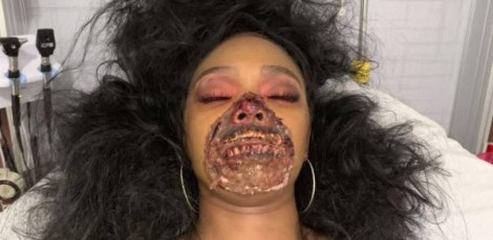 Das Gesicht sieht entstellt aus. Tatsächlich ist es aber nur ein sehr aufwendiges Halloween-Make-Up.