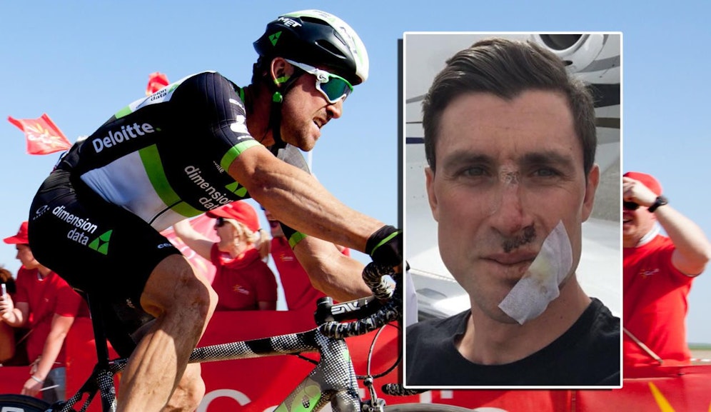 "Mein Gesicht hat schon bessere Tage gesehen", sagt Bernhard Eisel.