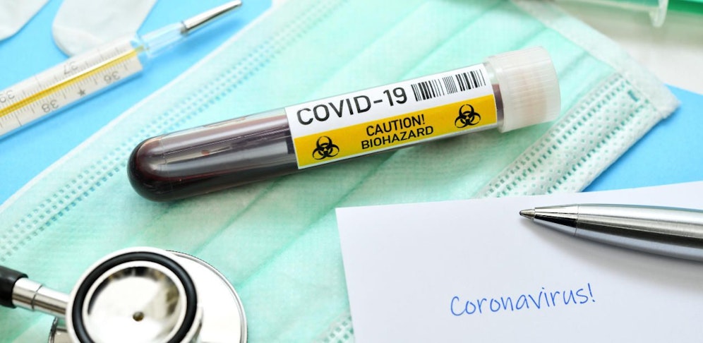 Weitere Coronafälle wurden in Österreich bekannt, einer davon in NÖ.