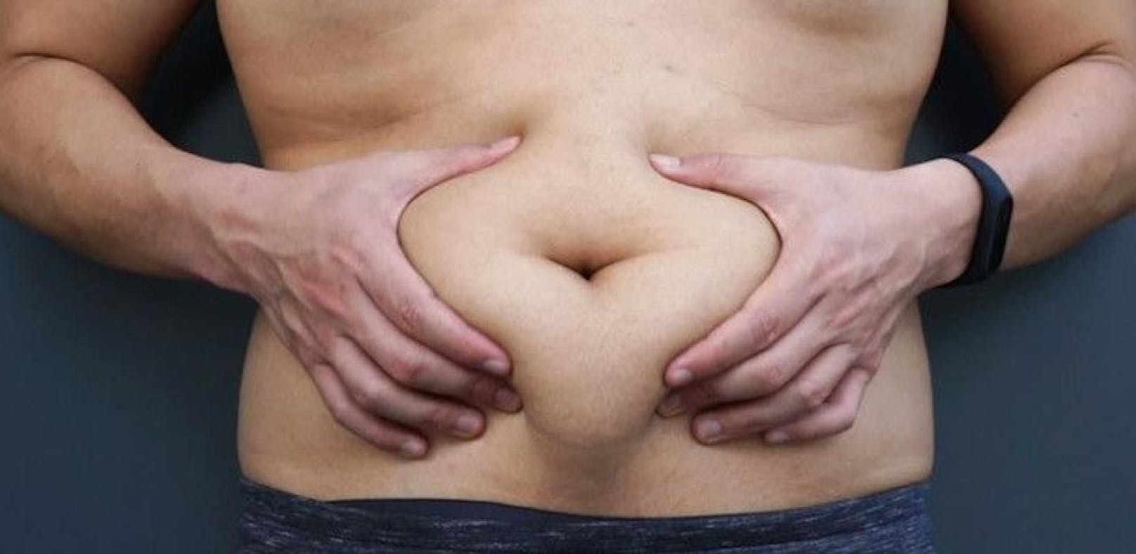 Im Bauchraum gespeichertes Fett gilt im Vergleich zu subkutanem [unter der Haut liegendem] Fett als eher krankheitsverursachend.