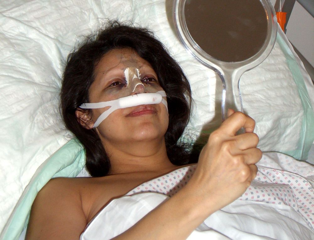 Heute.at - Leben für die Schönheit: Neue Nase für Daniela