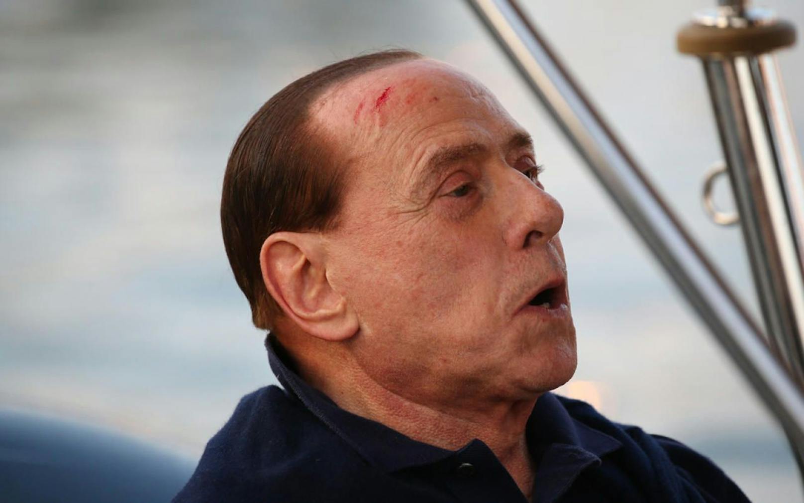 Berlusconi nach Sturz im Krankenhaus behandelt