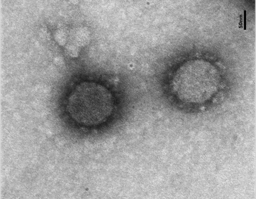 So sieht das "österreichische" Coronavirus aus.