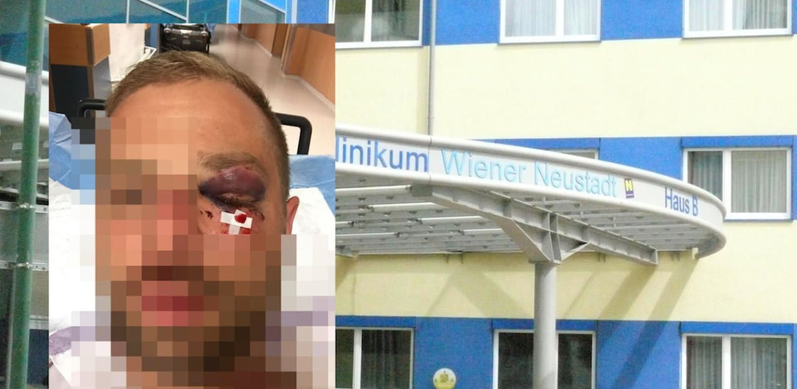 Beachparty: Beamter von Duo ins Spital geprügelt