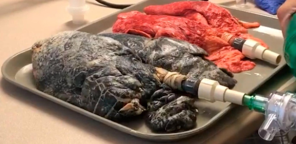 Die linke Lunge hat 20 Jahre Raucherdasein hinter sich.