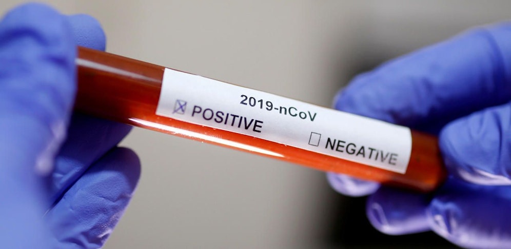 Neun Corona-Tote in NÖ gab es bereits außerhalb von Spitälern.