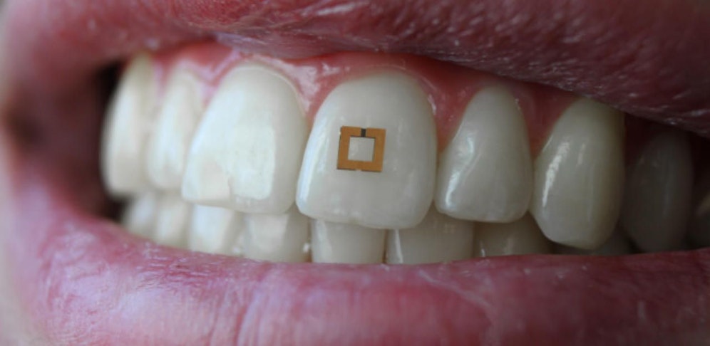 Der Chip meldet Nahrungsstoffe ans Handy.