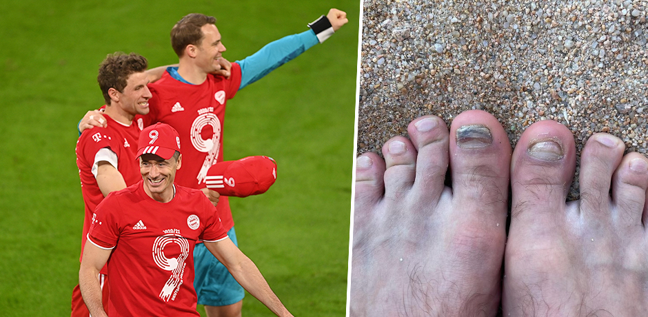 Thomas Müller zeigt seine Füße