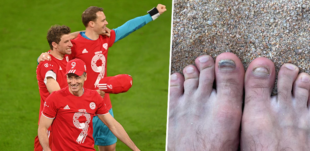 Thomas Müller zeigt seine Füße