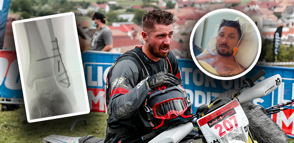 Marcel Hirscher zieht sich einen Beinbruch zu. 