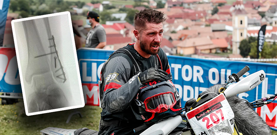 Marcel Hirscher brach sich bei einem Enduro-Sturz das Bein.