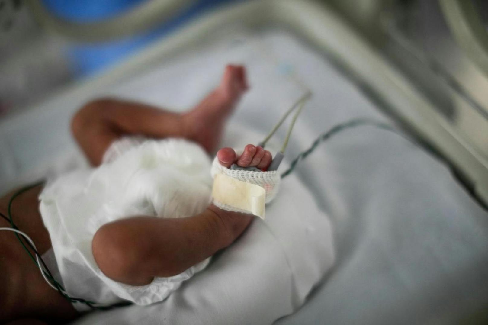 In Israel ist ein Mädchen zur Welt gekommen, das einen toten Fötus im Bauch trug. (Symbolbild)