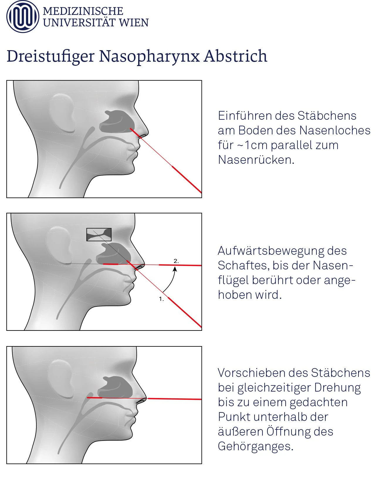 Diesen 3-Stufen-Plan schlägt die MedUni Wien für dir Durchführung von Nasenrachenabstrichen vor.