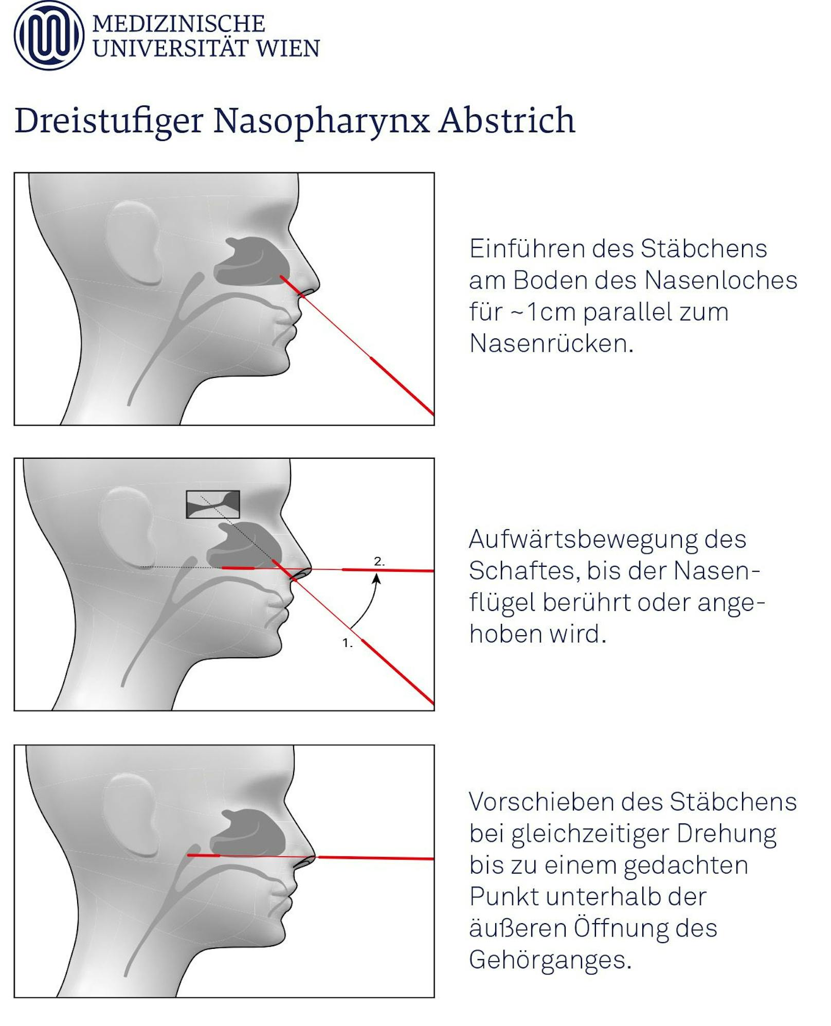 Diesen 3-Stufen-Plan schlägt die MedUni Wien für dir Durchführung von Nasenrachenabstrichen vor.