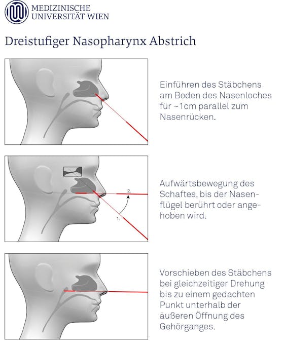 Diesen 3-Stufen-Plan schlägt die MedUni Wien für dir Durchführung von Nasenrachenabstrichen vor.