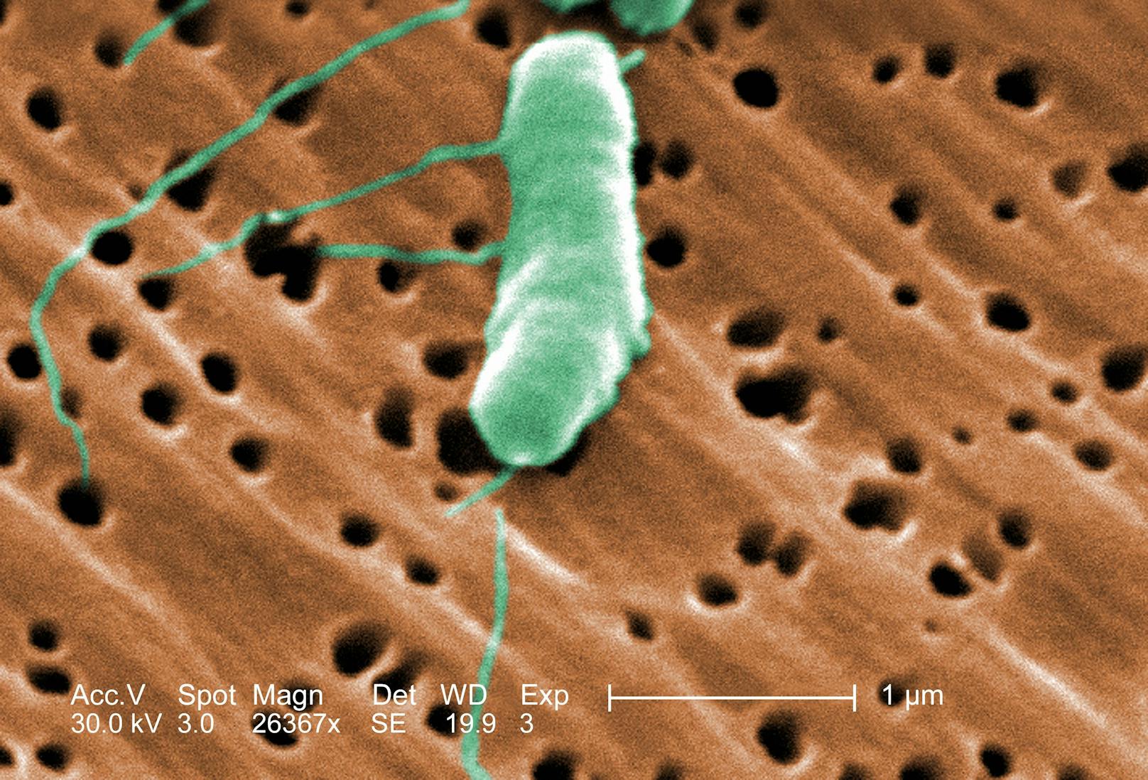 So sieht das Bakterium Vibrio vulnificus unter dem Elektronenmikroskop aus.