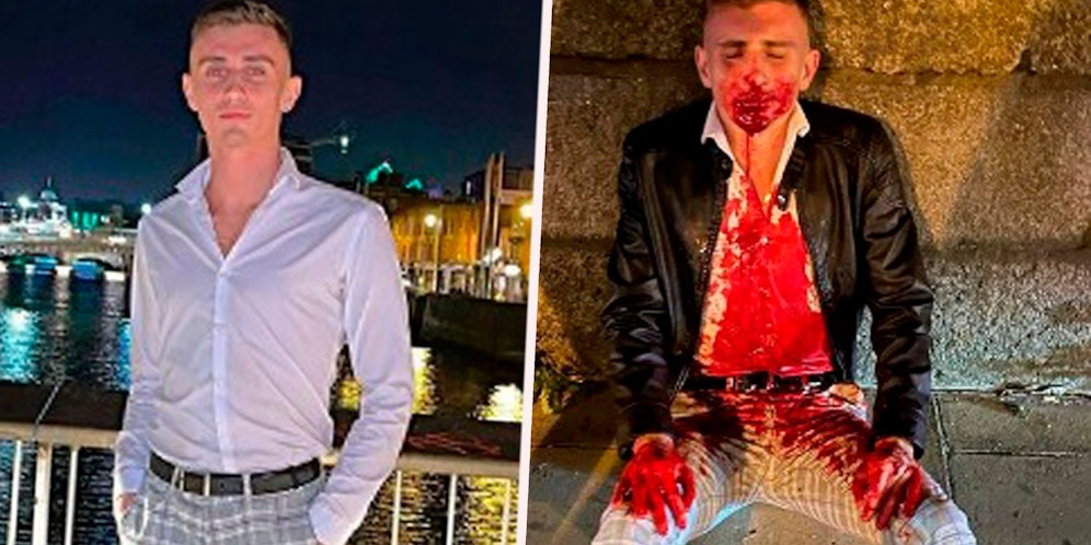 Jack Woolley posiert beim Ausgehen, sitzt zwei Minuten später blutüberströmt auf der Straße.