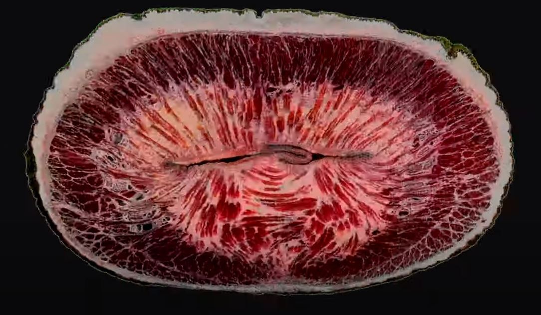 Das MRT zeigt die unglaublichen 40.000 Muskeln, die die feinen Bewegungen steuern.&nbsp;