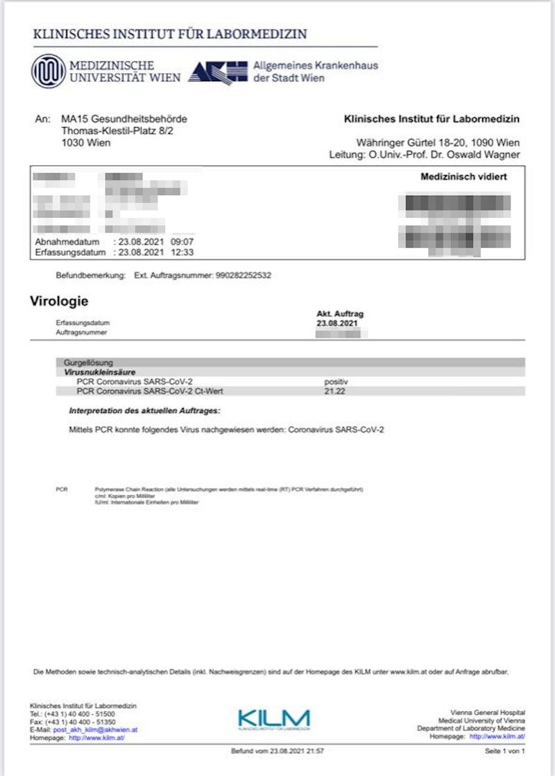 Freiwillig fuhr der Wiener weiter zur Teststraße auf der Donauinsel und machte dort einen PCR-Test. Dieser fiel positiv aus, das Ergebnis bekam der Wiener am Abend zugesandt.