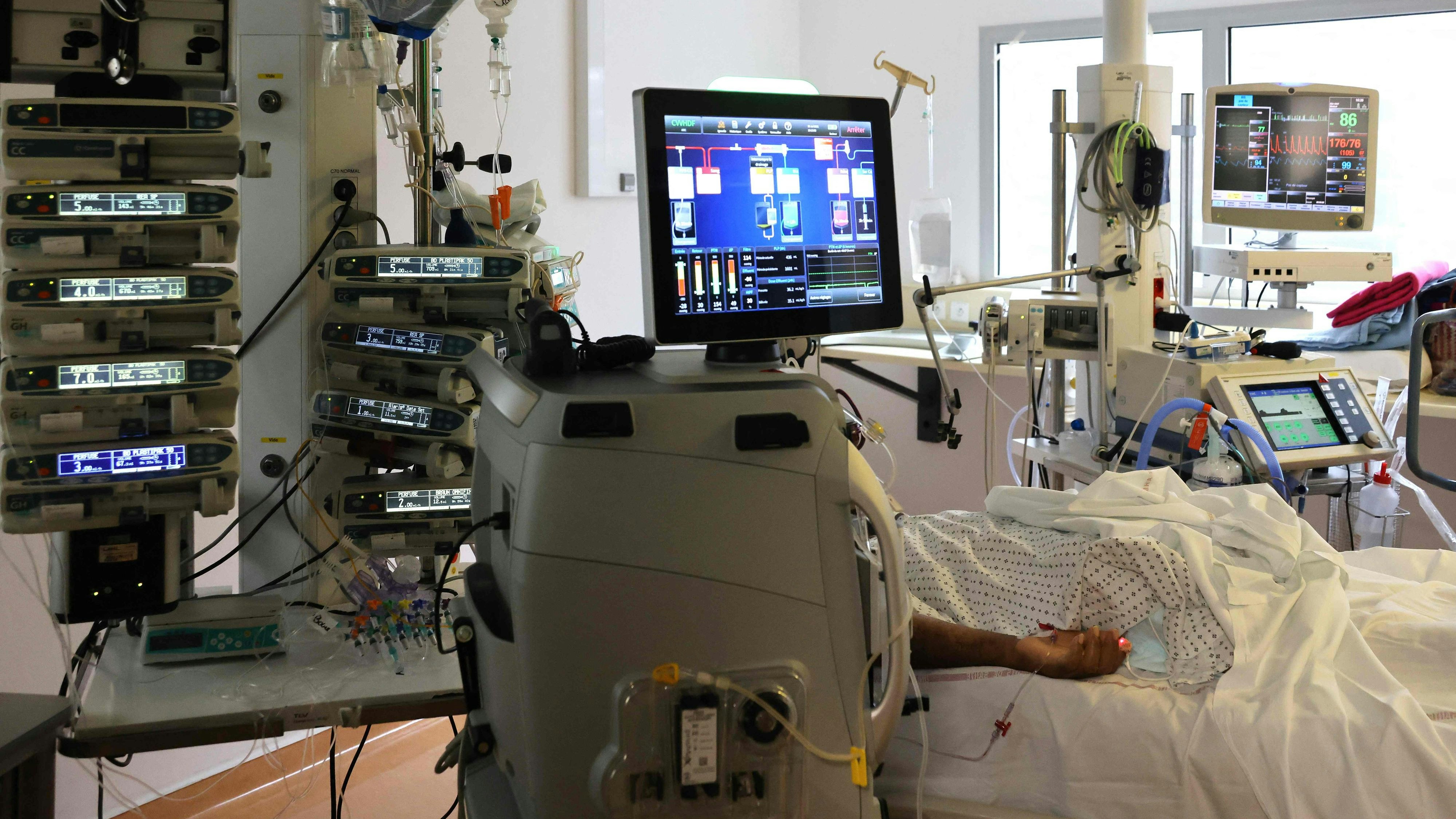 Download von www.picturedesk.com am 03.09.2021 (18:52).  A Covid-19 patient lays on a bed in the intensive care unit of the hospital (Centre hospitalier universitaire) of Saint-Pierre, on the French Indian Ocean island of La Reunion on July 30, 2021. - Since July 13, 2021, La Reunion has declared a state of health emergency. In one week, the number of positive cases has risen from 2,241 to 3,537, according to the prefecture, and the daily case incidence rate risen from 280 cases to 995 per 100,000 inhabitants. (Photo by Richard BOUHET / AFP) - 20210730_PD23536 - Rechteinfo: Rights Managed (RM) Nur für redaktionelle Nutzung! Werbliche Nutzung erfordert Freigabe: bitte schicken Sie uns eine Anfrage.