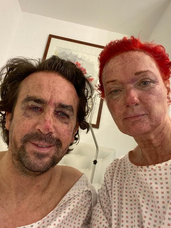 Star-Coiffeur Josef Winkler und Ehefrau Karin unterzogen sich einer Verjüngungskur.