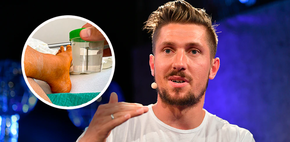 Marcel Hirscher zeigt sein gebrochenes Bein. 